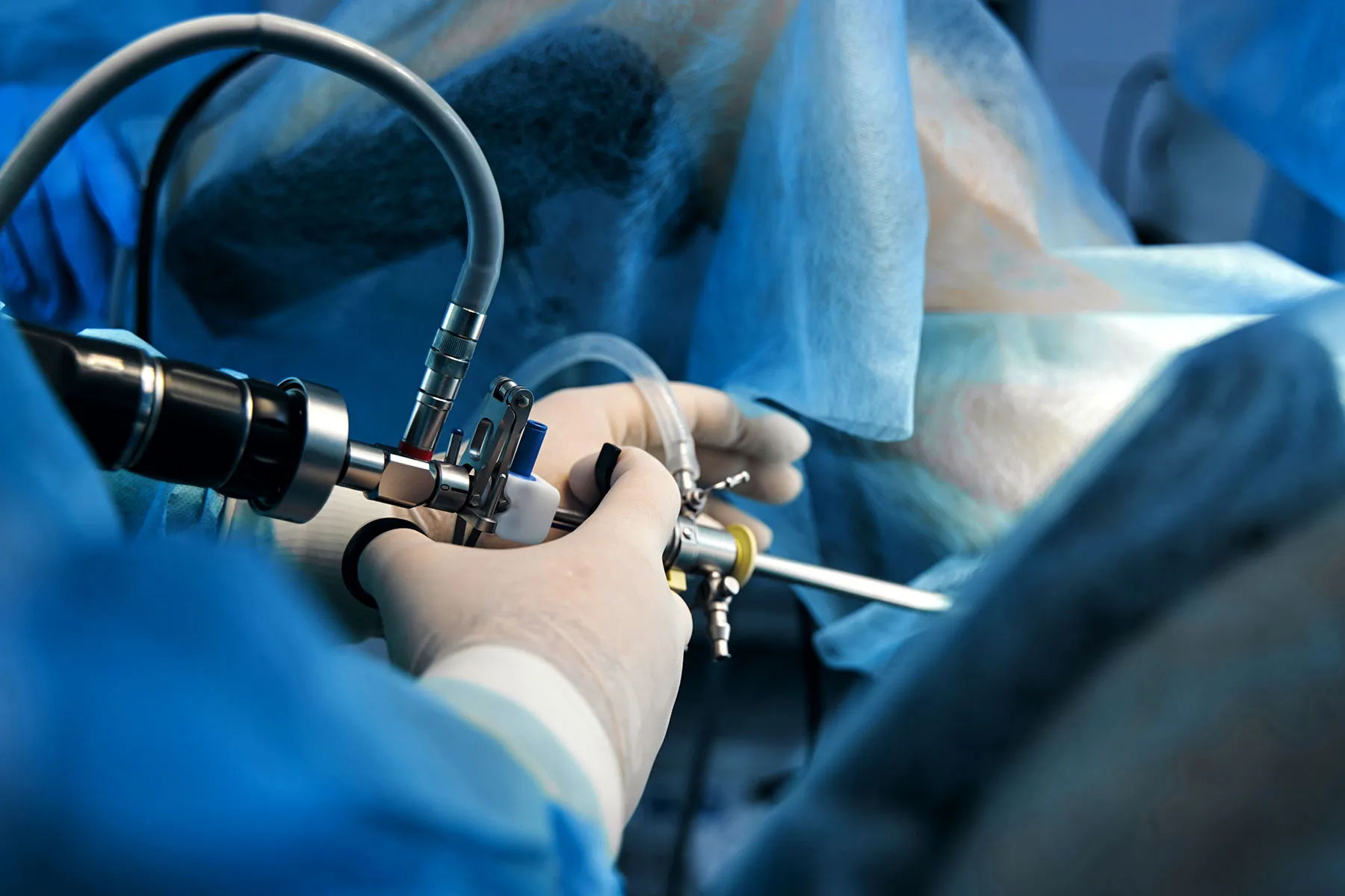 Hysteroscopy & Fertility Treatment